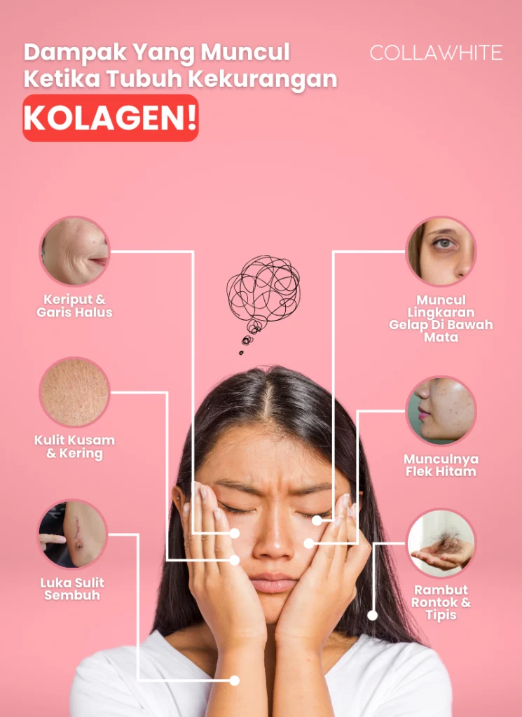 dampak kekurangan kolagen potrait